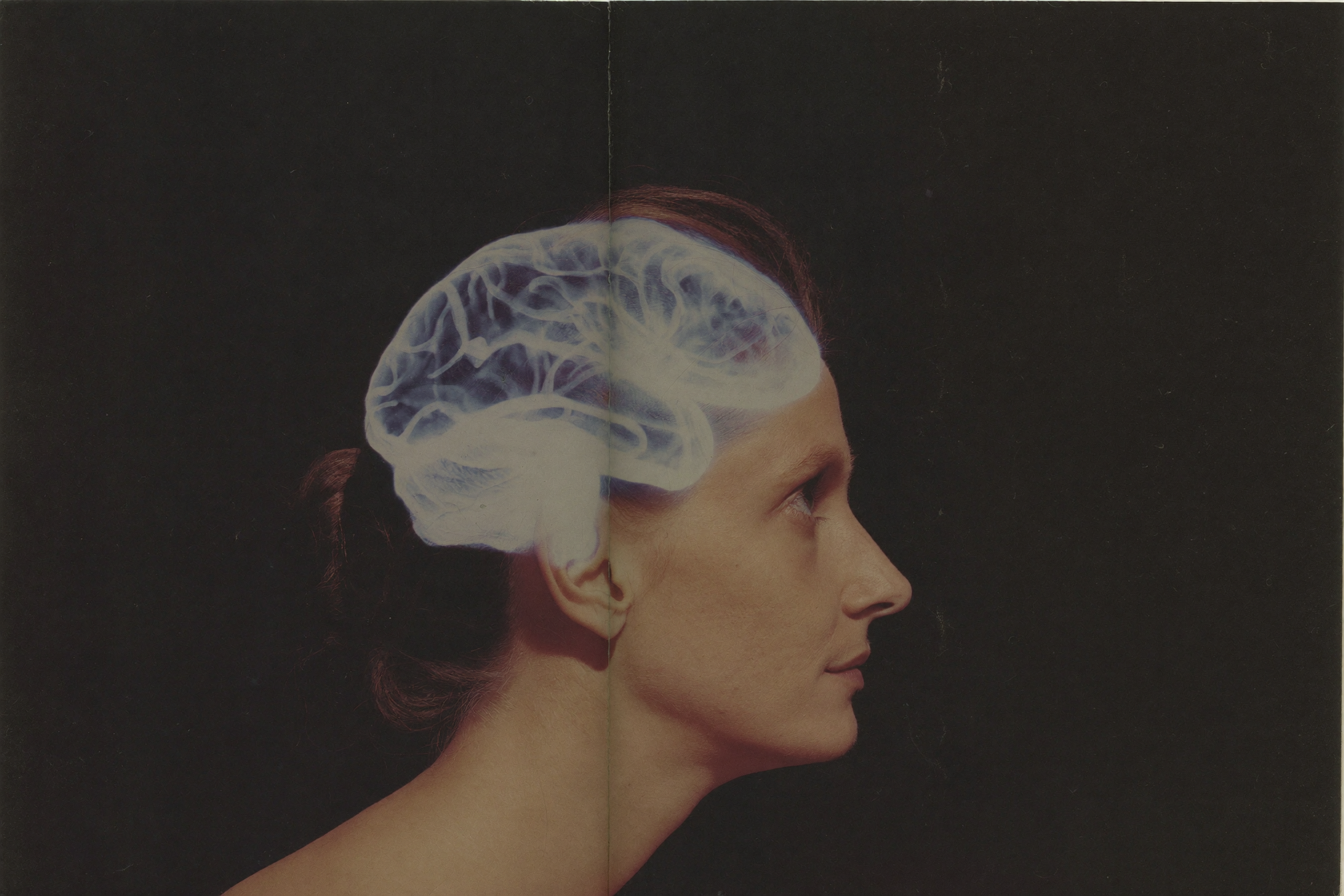 Profile of a woman with a translucent illustration of the brain
